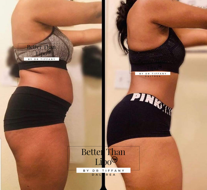 BETTER THAN LIPO™️ Cream