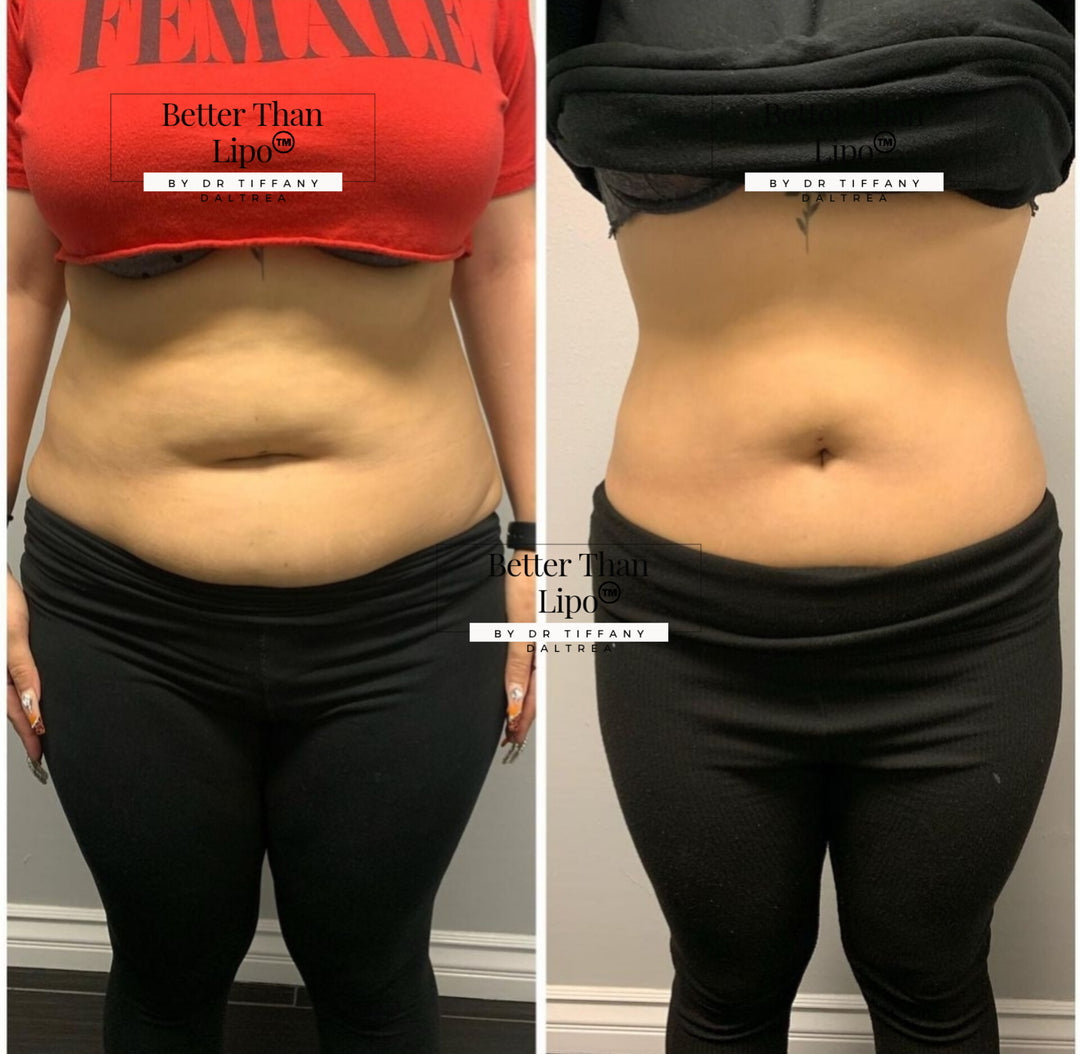 BETTER THAN LIPO™️ Cream