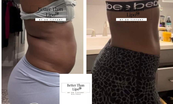 BETTER THAN LIPO™️ Cream