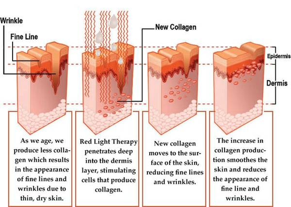 Better Than Lipo 4D ~ At Home System